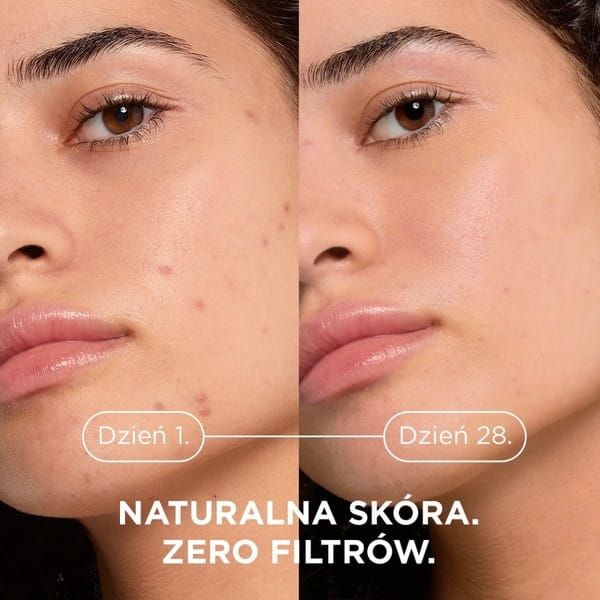 Bioderma Sebium Kerato+ żel-krem przeciwtrądzikowy 30 ml