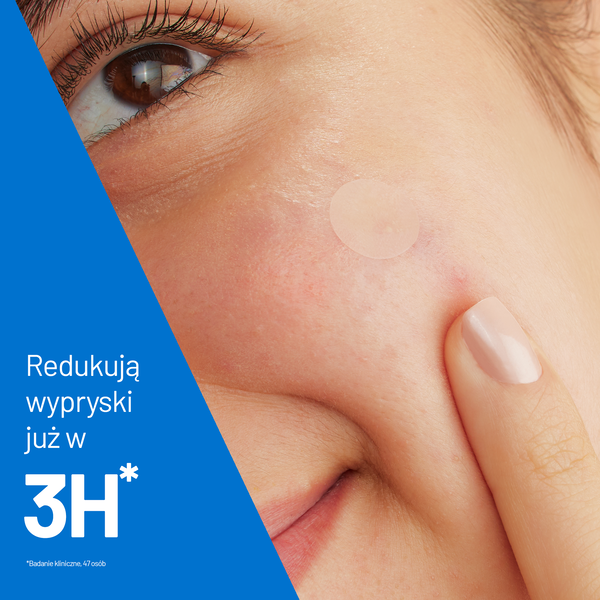 CeraVe punktowe plasterki na wypryski 22 szt.