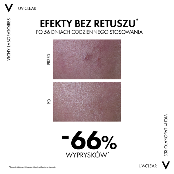 Vichy Capital Soleil fluid przeciw niedoskonałościom, SPF 50+ 40 ml