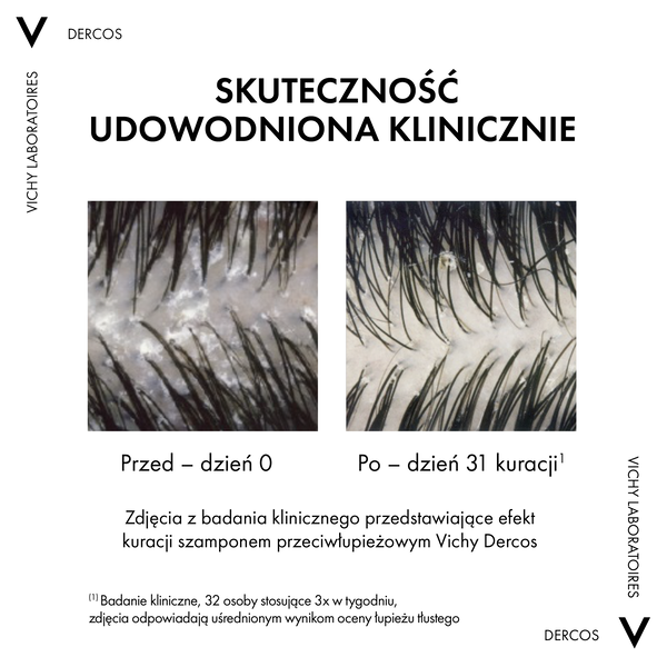 Vichy Dercos DS szampon przeciwłupieżowy, włosy normalne i przetłuszczające się 390 ml